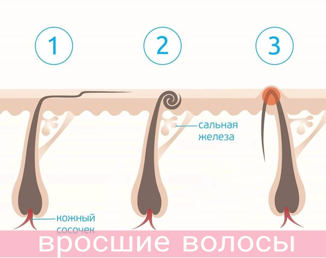 sugaring_gdynia_wolkowysk