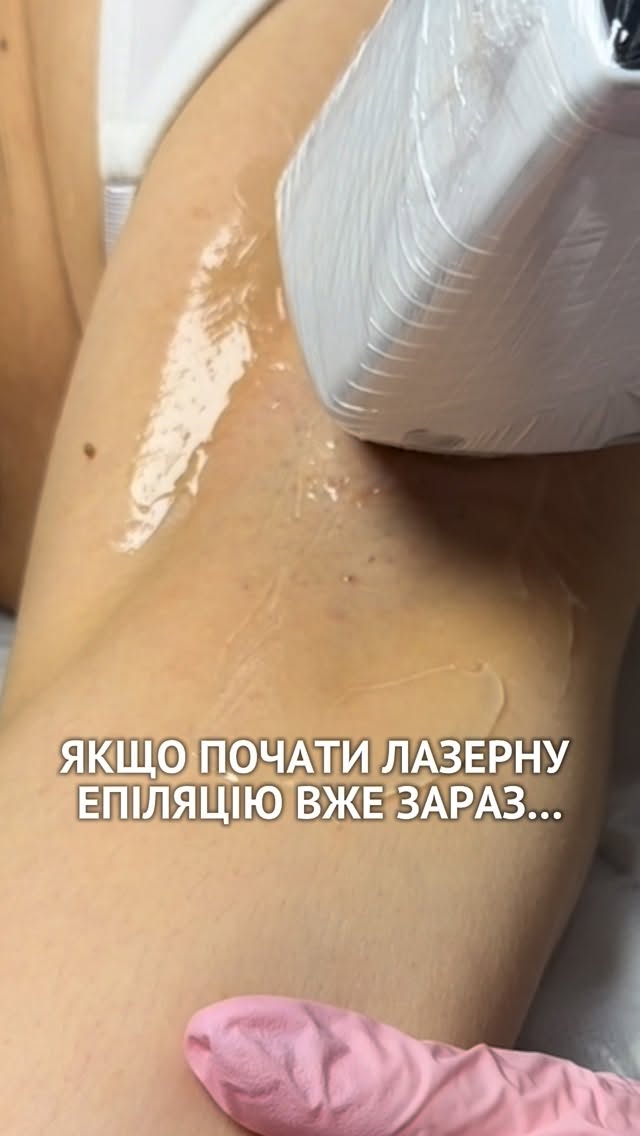 irina.epil.base