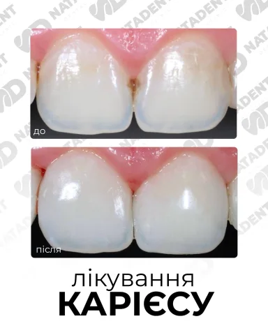 natadent_stomatologia