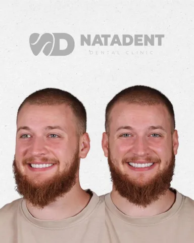 natadent_stomatologia