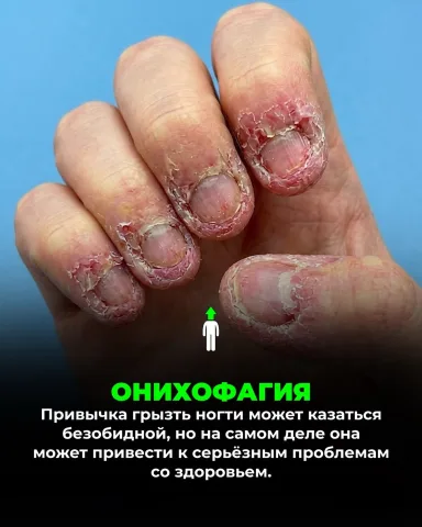 nails_hacker