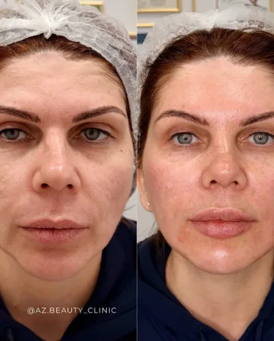 az.beauty_clinic