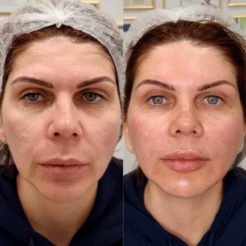 anna_zavolovich_cosmetolog