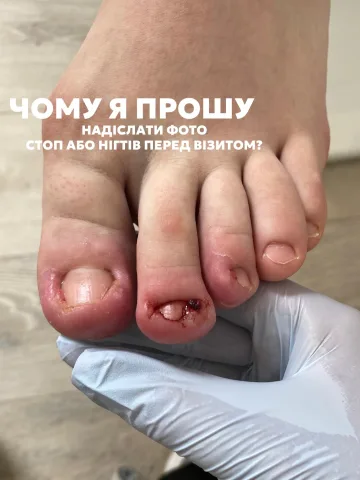shcherbata_nails