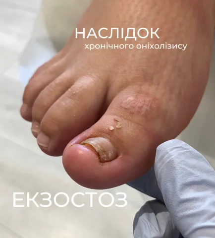 shcherbata_nails