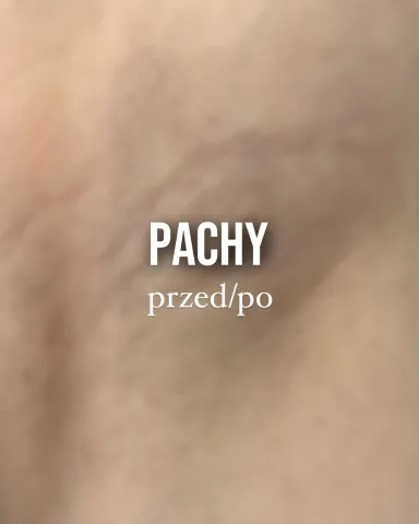 kseni_epil