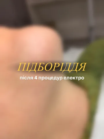 kseni_epil