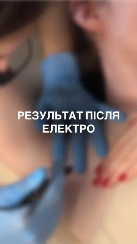 kseni_epil