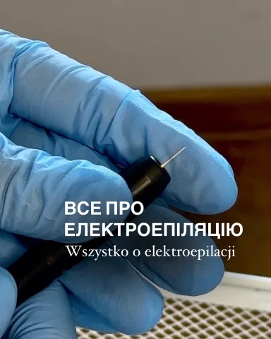 kseni_epil